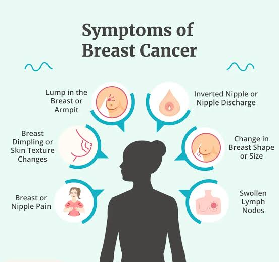 Major HER2-Positive Breast Cancer Trial Identifies Patients Who May Respond to Less Intensive Chemotherapy