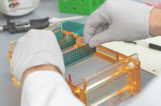 New Study Identifies Fat-Storing Gene That May Increase Anorexia Nervosa Risk
