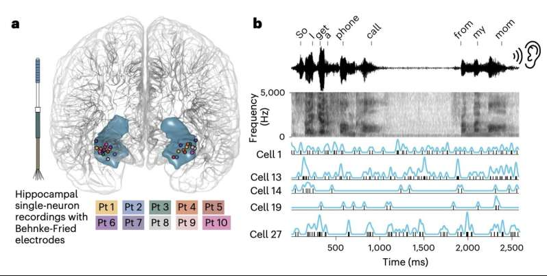 New Research Uses Language-Model-Inspired Methods to Investigate How Brain Cells Encode Meaning