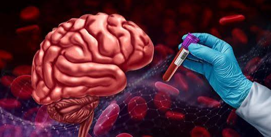 New Alzheimer’s Biomarker Research Highlights the Potential Role of Blood Tests in Clinical Assessment